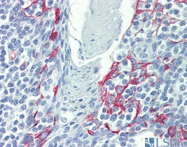 LIMD1 Antibody in Immunohistochemistry (IHC)