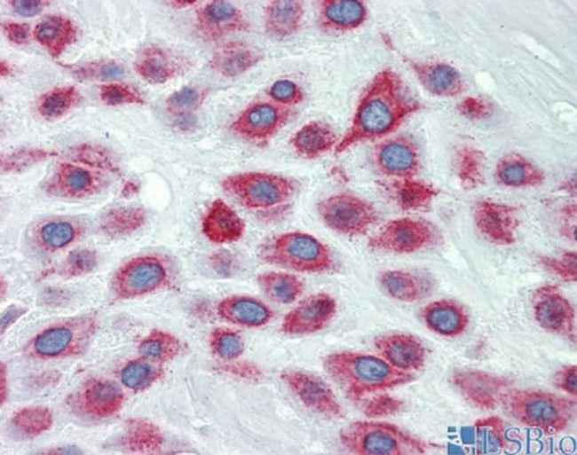 LIMD1 Antibody in Immunohistochemistry (IHC)