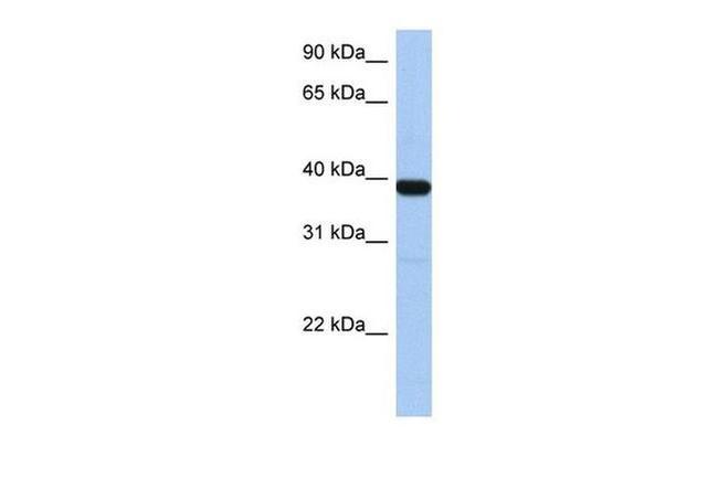 ZNF781 Antibody in Western Blot (WB)