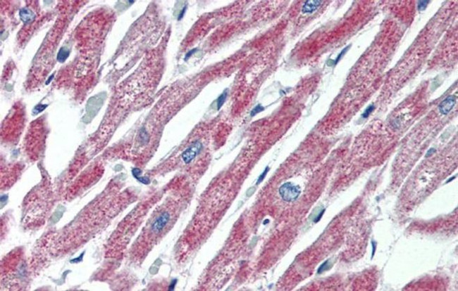 MAS1 Antibody in Immunohistochemistry (IHC)