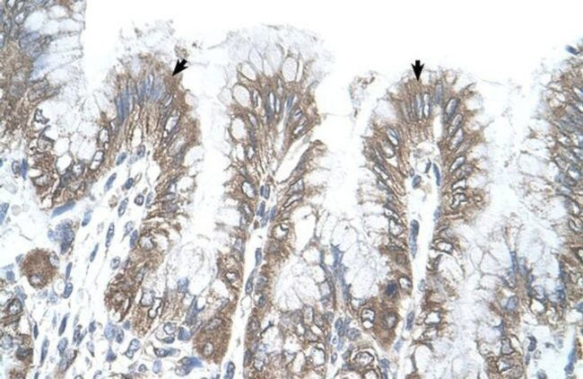 RSRC2 Antibody in Immunohistochemistry (IHC)