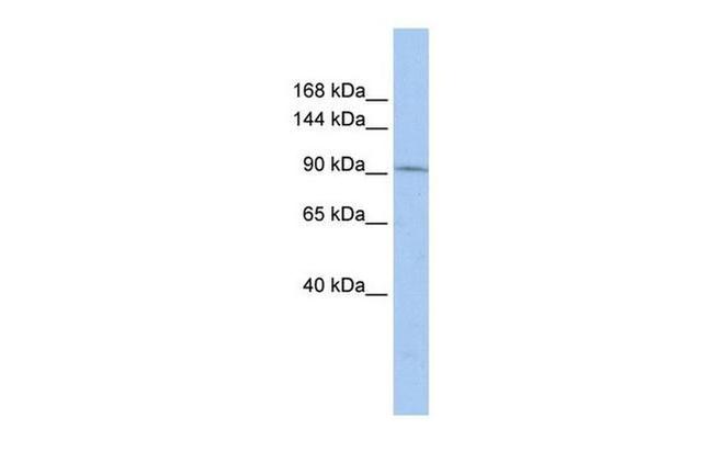 TAF3 Antibody in Western Blot (WB)