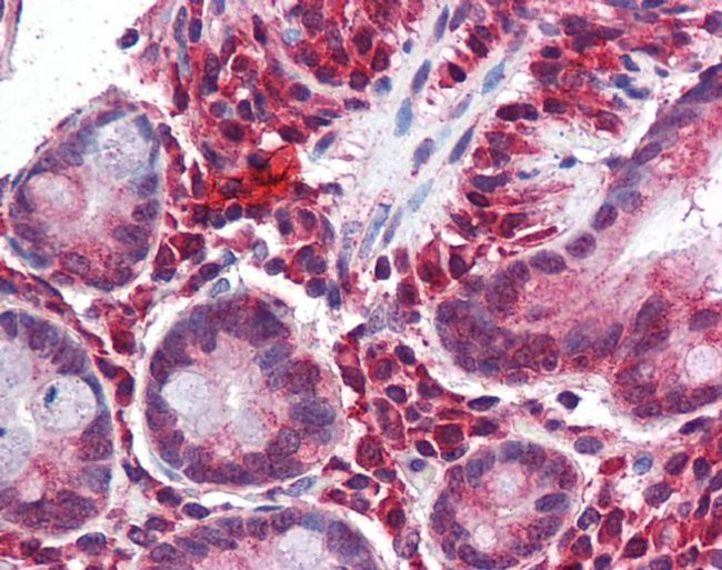 MGP Antibody in Immunohistochemistry (IHC)