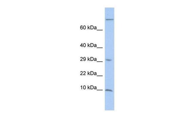 MGP Antibody in Western Blot (WB)