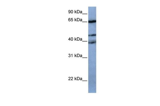 ZNF681 Antibody in Western Blot (WB)