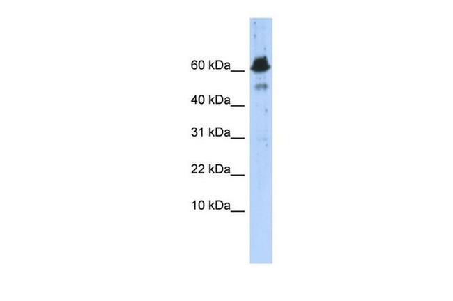 ABAT Antibody in Western Blot (WB)