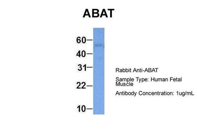 ABAT Antibody in Western Blot (WB)