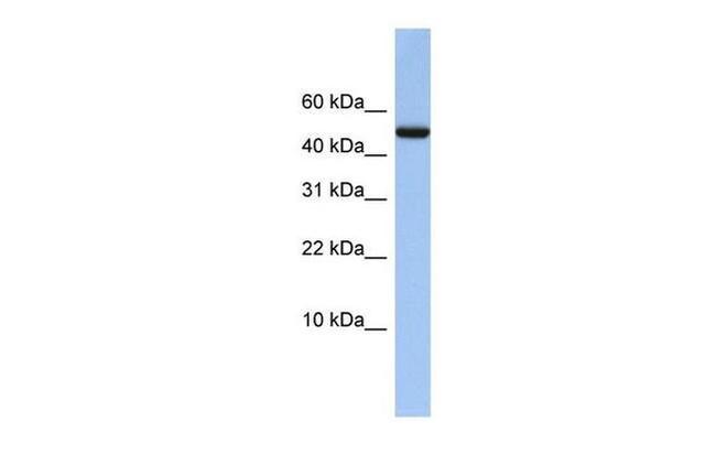 ABAT Antibody in Western Blot (WB)