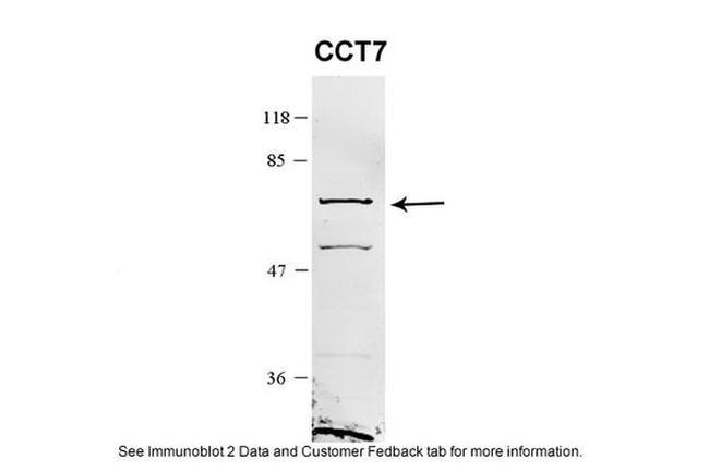 TCP-1 eta Antibody in Western Blot (WB)