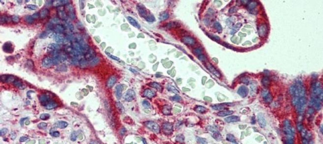 CYP11A1 Antibody in Immunohistochemistry (IHC)