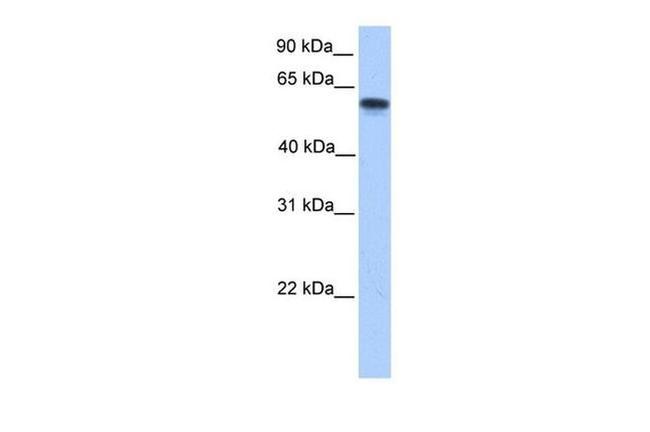 CYP11A1 Antibody in Western Blot (WB)