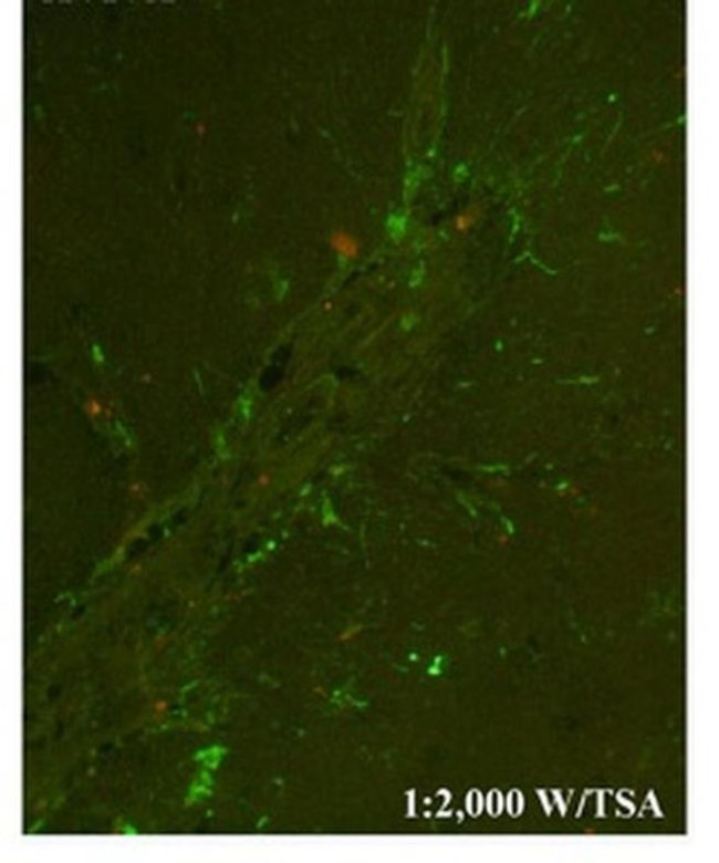 CHI3L1 Antibody in Immunocytochemistry (ICC/IF)