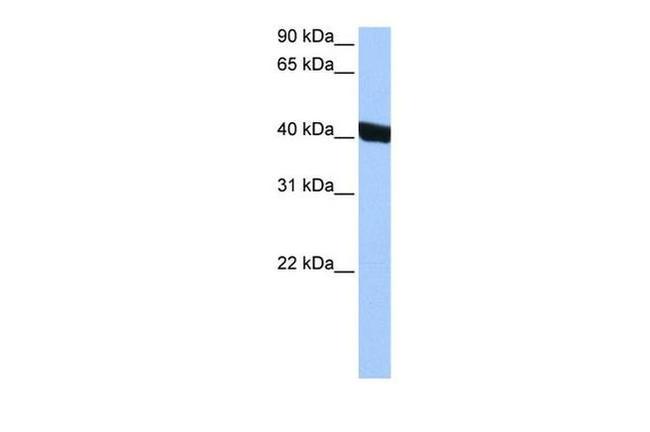 CHI3L1 Antibody in Western Blot (WB)