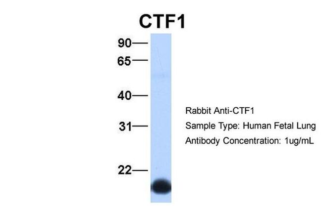 Cardiotrophin 1 Antibody in Western Blot (WB)