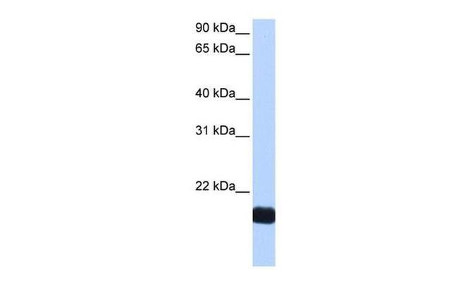 Cardiotrophin 1 Antibody in Western Blot (WB)