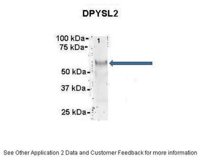 CRMP2 Antibody in Immunoprecipitation (IP)