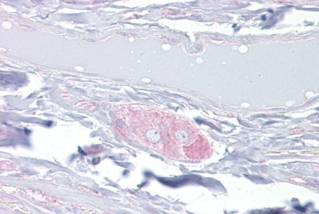 DPYSL3 Antibody in Immunohistochemistry (IHC)