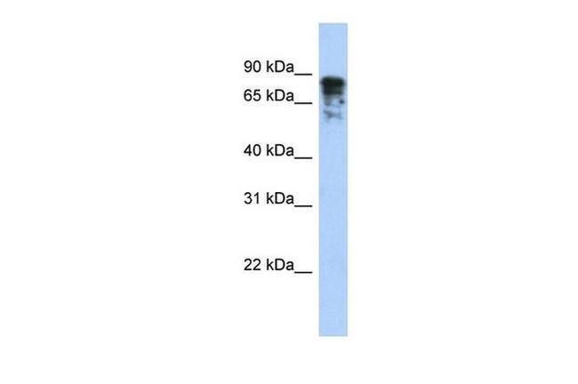 DPYSL3 Antibody in Western Blot (WB)