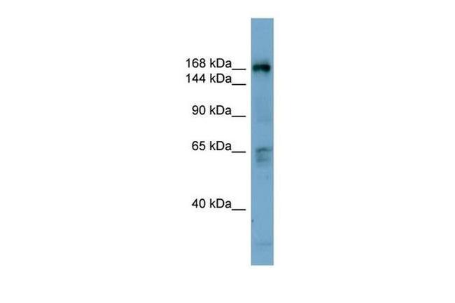 DOCK2 Antibody in Western Blot (WB)