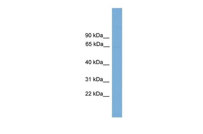 POLR3C Antibody in Western Blot (WB)