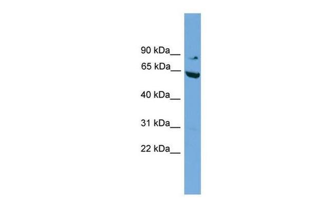 RALBP1 Antibody in Western Blot (WB)