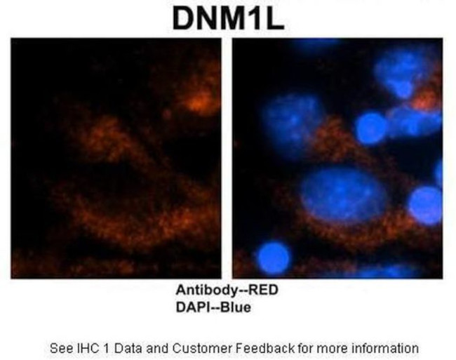 DNM1L Antibody in Immunohistochemistry (IHC)