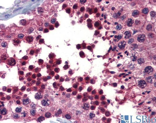 hCV-2 Antibody in Immunohistochemistry (IHC)