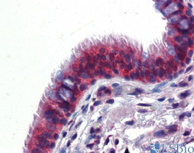 hCV-2 Antibody in Immunohistochemistry (IHC)