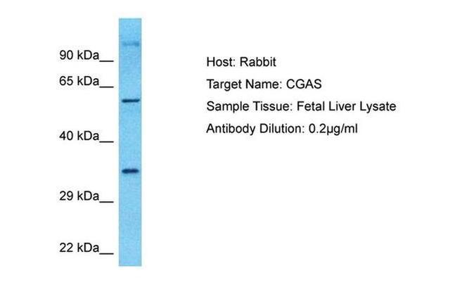 cGAS Antibody in Western Blot (WB)