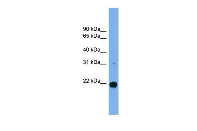 MITD1 Antibody in Western Blot (WB)