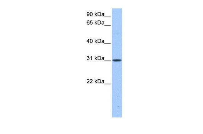 HUS1B Antibody in Western Blot (WB)