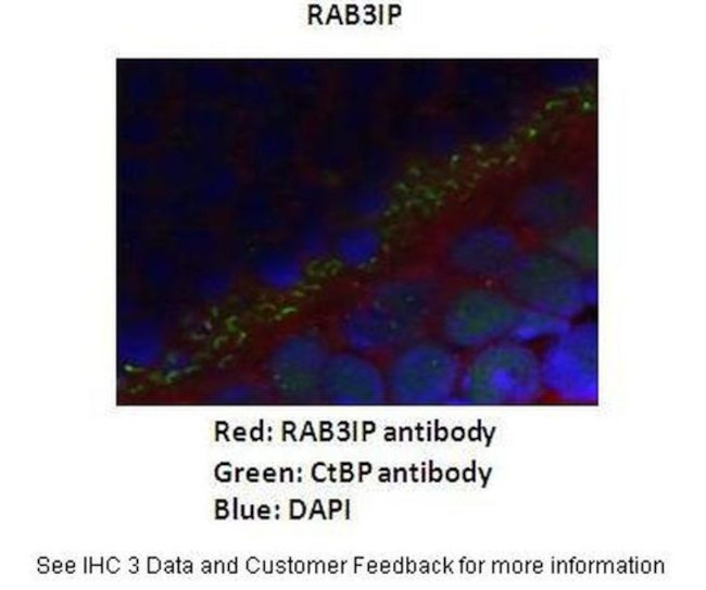 RAB3IP Antibody in Immunohistochemistry (IHC)
