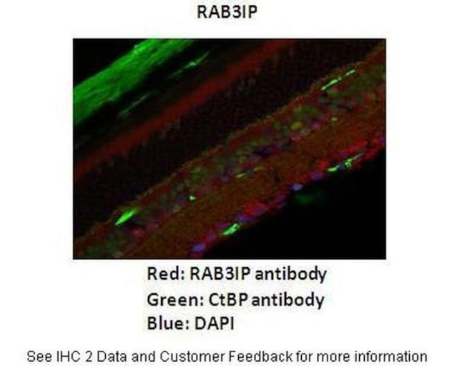 RAB3IP Antibody in Immunohistochemistry (IHC)