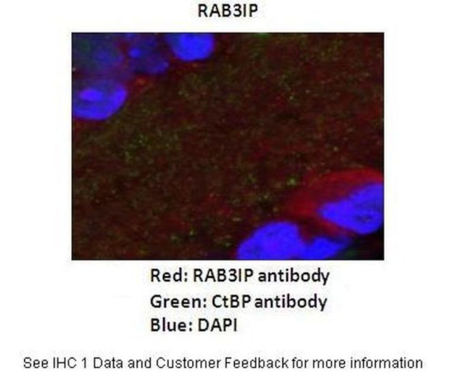 RAB3IP Antibody in Immunohistochemistry (IHC)