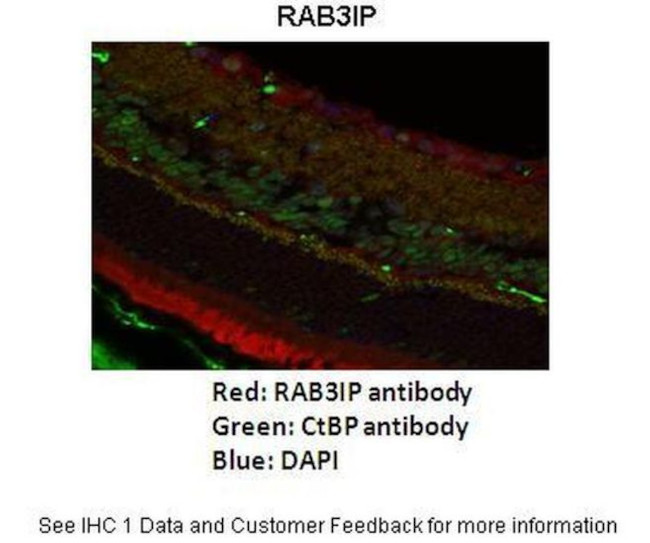 RAB3IP Antibody in Immunohistochemistry (IHC)