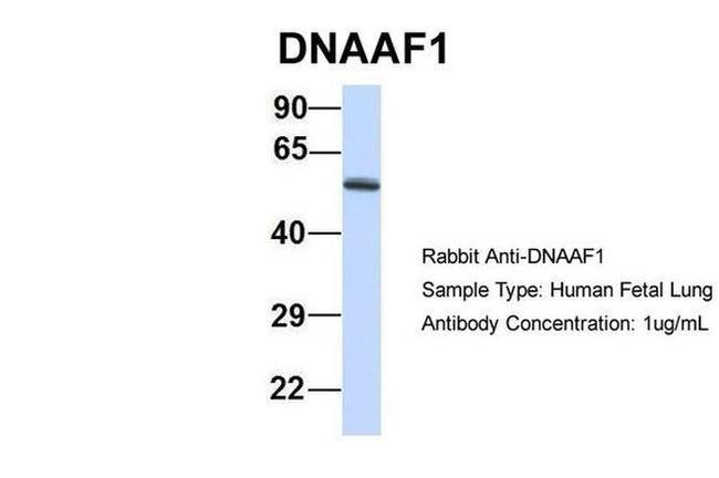 LRRC50 Antibody in Western Blot (WB)