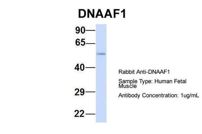 LRRC50 Antibody in Western Blot (WB)