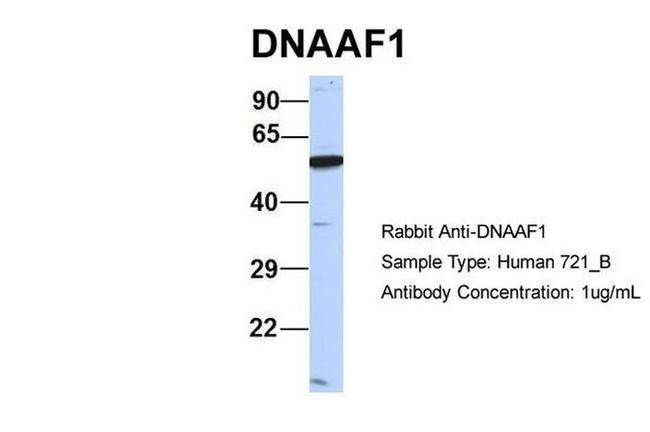 LRRC50 Antibody in Western Blot (WB)