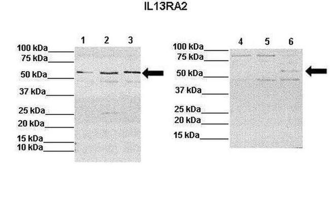 IL13RA2 Antibody in Western Blot (WB)