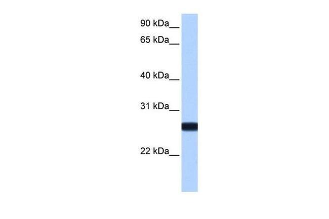 IL13RA2 Antibody in Western Blot (WB)