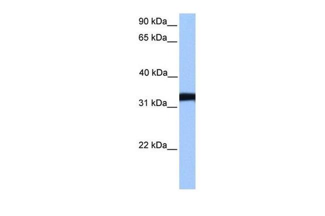 LDHC Antibody in Western Blot (WB)