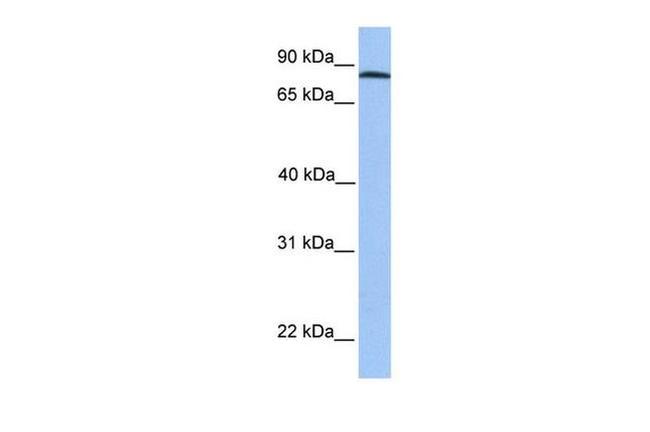 ADAM7 Antibody in Western Blot (WB)