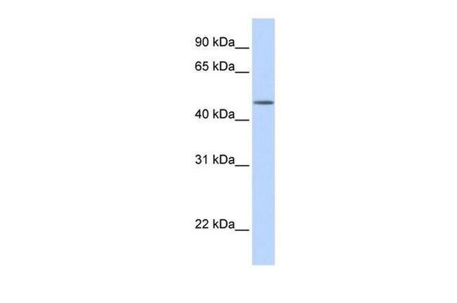 TBL2 Antibody in Western Blot (WB)