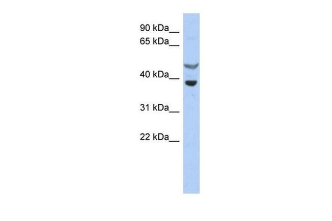 SOCS7 Antibody in Western Blot (WB)