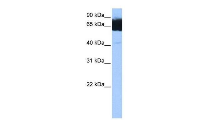 TTC12 Antibody in Western Blot (WB)