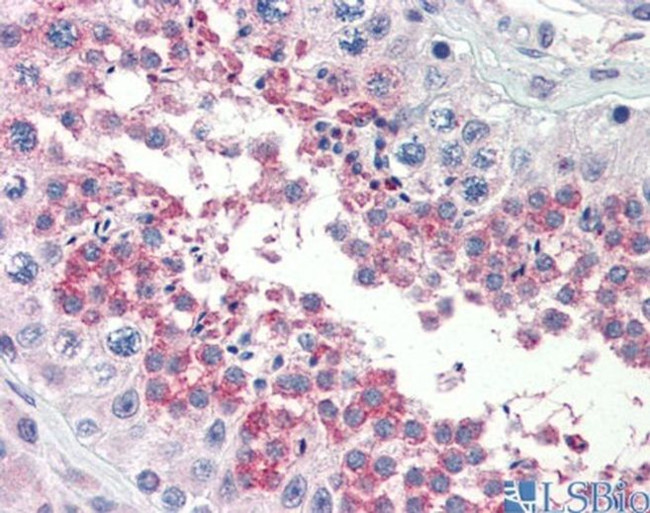 TSKS Antibody in Immunohistochemistry (IHC)