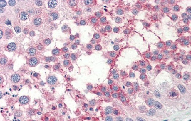 TSKS Antibody in Immunohistochemistry (IHC)