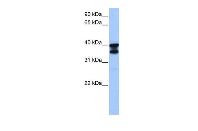 SLC25A31 Antibody in Western Blot (WB)