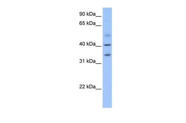 ZC3H14 Antibody in Western Blot (WB)