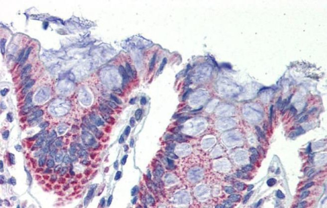 IMPDH1 Antibody in Immunohistochemistry (IHC)